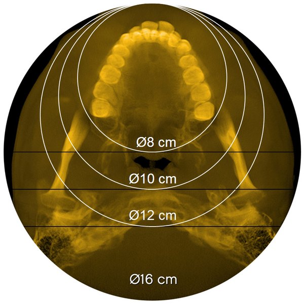 CS 8200 3D – FOV méretek: Ø8, Ø10, Ø12, Ø16 cm